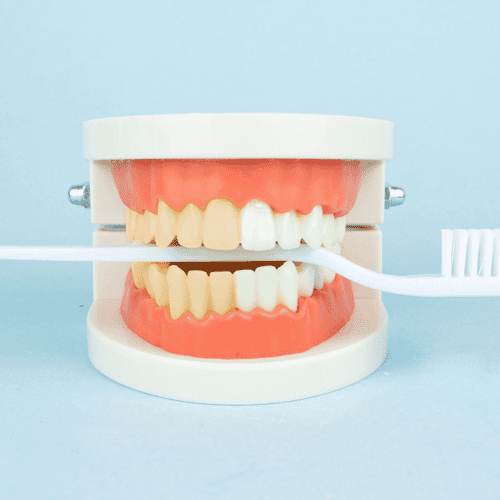 Save Up to 70% on High-Quality Dental Implants in Colombia